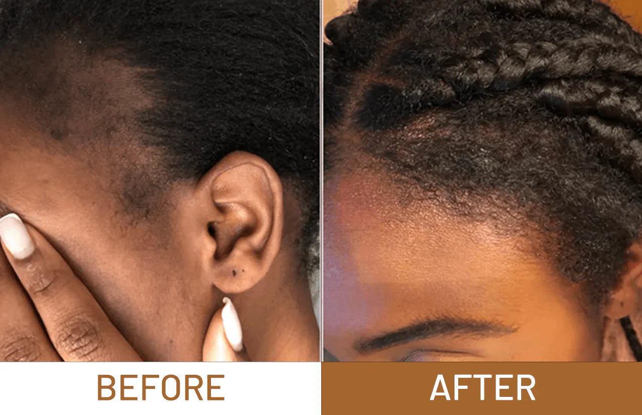 Batana Oil For Hair Growth, Hair Loss & Thicker Hair