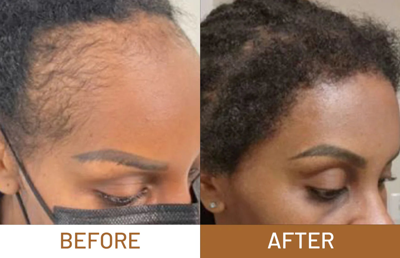 Batana Oil For Hair Growth, Hair Loss & Thicker Hair