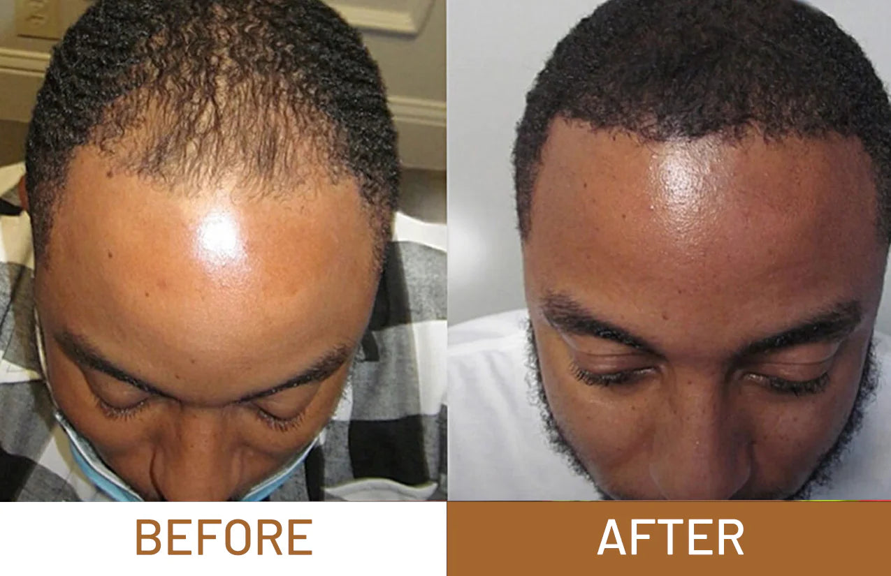 Batana Oil For Hair Growth, Hair Loss & Thicker Hair