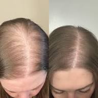 Batana Oil For Hair Growth, Hair Loss & Thicker Hair
